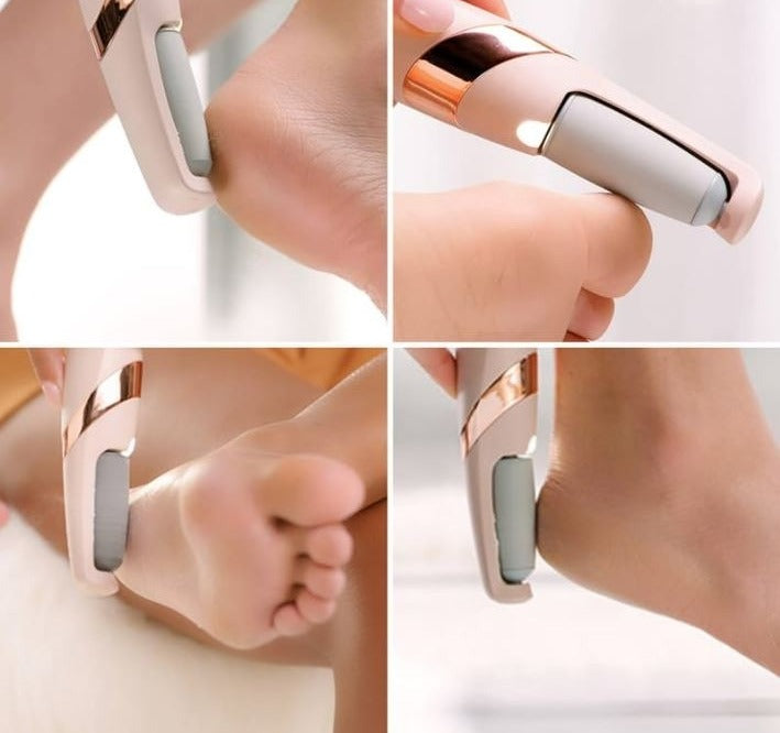 Electric Callus Remover for Feet – Rechargeable Pedi Foot File